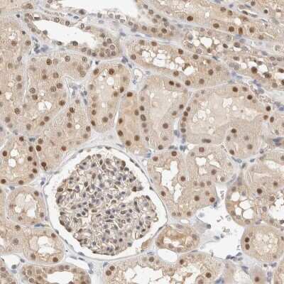 Immunohistochemistry-Paraffin: TSTD2 Antibody [NBP1-86695] - Staining of human kidney shows nuclear and cytoplasmic positivity in cells in tubules and glomeruli.