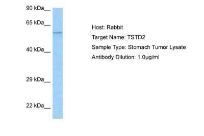 Western Blot: TSTD2 Antibody [NBP2-88508] - Host: Rabbit. Target Name: TSTD2. Sample Tissue: Stomach Tumor lysates. Antibody Dilution: 1ug/ml