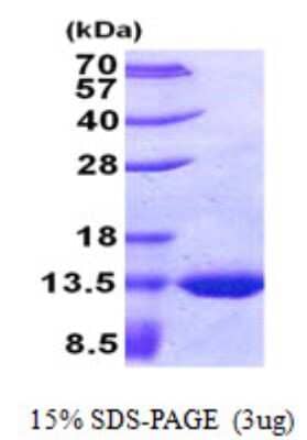 SDS-Page: TSTD2 Protein [NBP2-22640]