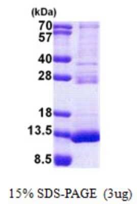 SDS-Page: TSTD3 Protein [NBP2-22862]