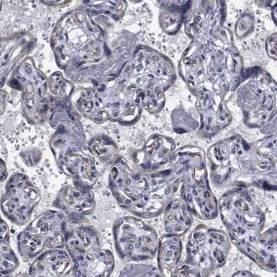 Immunohistochemistry-Paraffin: TTBK1 Antibody [NBP1-82888] - Staining of human placenta shows low positivity in trophoblastic cells as expected.
