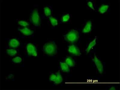Immunocytochemistry/Immunofluorescence: TTC1 Antibody [H00007265-B01P] - Analysis of purified antibody to TTC1 on HeLa cell. (antibody concentration 10 ug/ml)