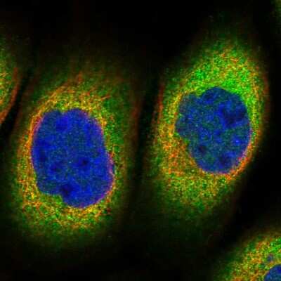 Immunocytochemistry/Immunofluorescence: TTC1 Antibody [NBP1-86921] - Immunofluorescent staining of human cell line A-431 shows localization to cytosol.
