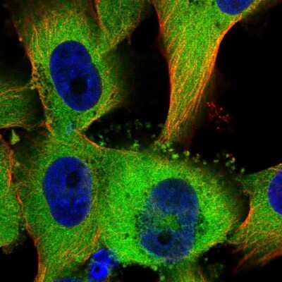 Immunocytochemistry/Immunofluorescence: TTC1 Antibody [NBP2-57145] - Staining of human cell line U-251 MG shows localization to cytosol.