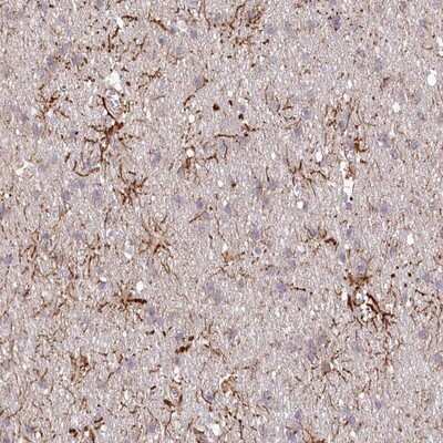 Immunohistochemistry-Paraffin: TTC1 Antibody [NBP1-86921] - Staining of human cerebral cortex shows strong cytoplasmic positivity in astrocytes.