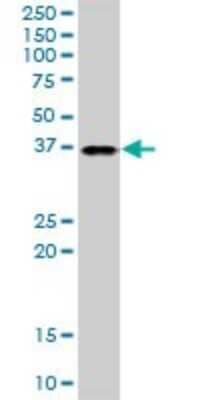 Western Blot: TTC1 Antibody [H00007265-B01P] - Analysis of TTC1 expression in Jurkat.