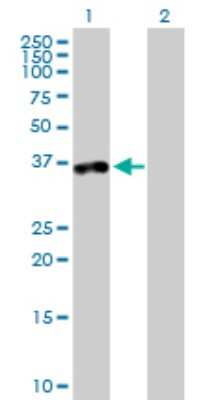 Western Blot: TTC1 Antibody [H00007265-B01P] - Analysis of TTC1 expression in transfected 293T cell line by TTC1 polyclonal antibody.  Lane 1: TTC1 transfected lysate(32.12 KDa). Lane 2: Non-transfected lysate.