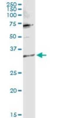 Western Blot: TTC1 Antibody [H00007265-D01P] - Analysis of TTC1 expression in mouse brain.