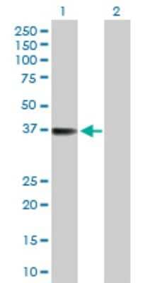 Western Blot: TTC1 Antibody [H00007265-D01P] - Analysis of TTC1 expression in transfected 293T cell line by TTC1 polyclonal antibody.Lane 1: TTC1 transfected lysate(33.50 KDa).Lane 2: Non-transfected lysate.