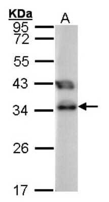 Western Blot: TTC1 Antibody [NBP1-30972] - Sample (30 ug of whole cell lysate) A: 293T 12% SDS PAGE; antibody diluted at 1:1000.