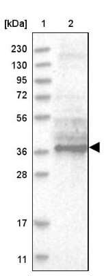 Western Blot: TTC1 Antibody [NBP1-86921] - Lane 1: Marker [kDa] 230, 130, 95, 72, 56, 36, 28, 17, 11Lane 2: Human cell line RT-4
