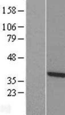 Western Blot: TTC1 Overexpression Lysate (Adult Normal) [NBL1-17397] Left-Empty vector transfected control cell lysate (HEK293 cell lysate); Right -Over-expression Lysate for TTC1.