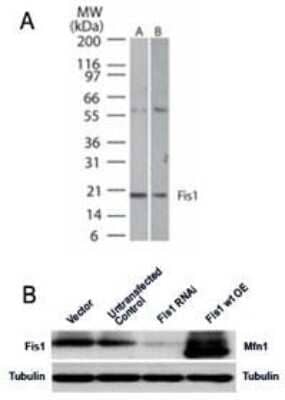 Knockdown Validated: TTC11 Antibody [NB100-56646] - Analysis of Fis1 in A) human HeLa and B) mouse NIH 3T3 lysate using Fis1 antibody at 1:1000 dilution. B. Specificity validation of the Fis1 antibody. Fis1 was analyzed in M17 cells stably transfected with vector only, Fis1 RNAi, Fis1 (Fis1wt OE) or left untransfected (negative control). The western blot data showed that M17 cells expressed Fis1 (Vector, Untransfected control) which could be knocked down by Fis1 RNAi. Cells transfected with Fis1 overexpressed Fis1. M17 is a human neuroblastoma cell line.