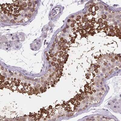 Immunohistochemistry-Paraffin: TTC12 Antibody [NBP2-57113] - Immunohistochemical staining of human testis shows strong cytoplasmic positivity in  cells in seminiferous ducts.