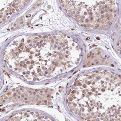 Immunohistochemistry-Paraffin: TTC12 Antibody [NBP2-58627] - Immunohistochemical staining of human testis shows moderate cytoplasmic positivity in cells in seminiferous ducts.