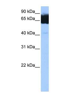 Western Blot: TTC12 Antibody [NBP1-56424] - Human Muscle lysate, concentration 0.2-1 ug/ml.