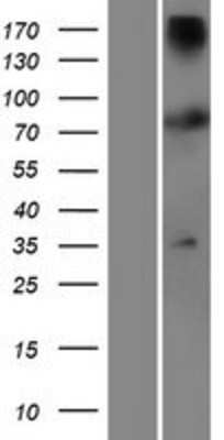 Western Blot TTC12 Overexpression Lysate