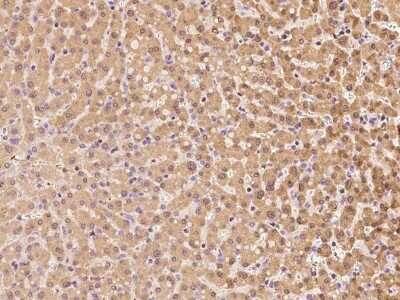 Immunohistochemistry-Paraffin: TTC14 Antibody [NBP2-97491] - Immunochemical staining of human TTC14 in human liver with rabbit polyclonal antibody at 1:100 dilution, formalin-fixed paraffin embedded sections.