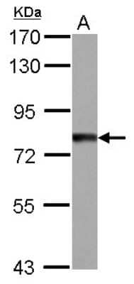 Western Blot: TTC14 Antibody [NBP2-20753] - Sample (30 ug of whole cell lysate) A: IMR32 7. 5% SDS PAGE gel, diluted at 1:1000.