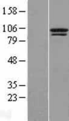 Western Blot: TTC14 Overexpression Lysate (Adult Normal) [NBL1-17398] Left-Empty vector transfected control cell lysate (HEK293 cell lysate); Right -Over-expression Lysate for TTC14.