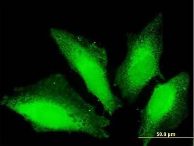 Immunocytochemistry/ Immunofluorescence TTC15 Antibody