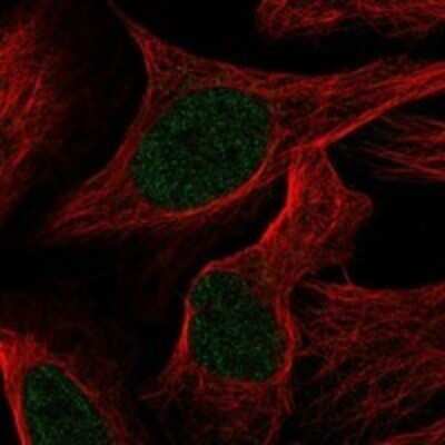 Immunocytochemistry/Immunofluorescence: TTC15 Antibody [NBP3-17557] - Staining of human cell line U-2 OS shows localization to nucleoplasm.