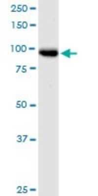 Western Blot TTC15 Antibody