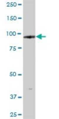 Western Blot: TTC15 Antibody [H00051112-B01P] - Analysis of TTC15 expression in human pancreas.