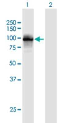 Western Blot TTC15 Antibody