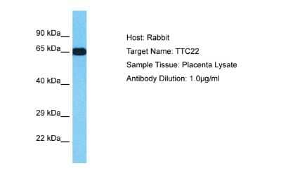 Western Blot: TTC22 Antibody [NBP2-83719] - Host: Rabbit. Target Name: TTC22. Sample Type: Placenta lysates. Antibody Dilution: 1.0ug/ml