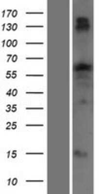 Western Blot: TTC22 Overexpression Lysate (Adult Normal) [NBP2-09394] Left-Empty vector transfected control cell lysate (HEK293 cell lysate); Right -Over-expression Lysate for TTC22.