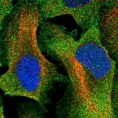 Immunocytochemistry/Immunofluorescence: TTC23 Antibody [NBP1-83718] - Staining of human cell line U-2 OS shows localization to plasma membrane & cytosol. Antibody staining is shown in green.