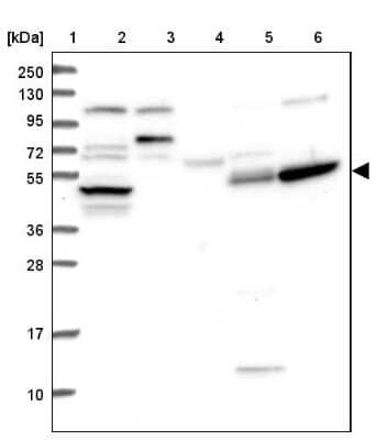Western Blot: TTC23 Antibody [NBP1-83718] - Lane 1: Marker  [kDa] 250, 130, 95, 72, 55, 36, 28, 17, 10.  Lane 2: Human cell line RT-4.  Lane 3: Human cell line U-251MG sp.  Lane 4: Human plasma (IgG/HSA depleted).  Lane 5: Human liver tissue.  Lane 6: Human tonsil tissue