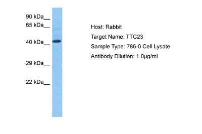 Western Blot: TTC23 Antibody [NBP2-88510] - Host: Rabbit. Target Name: TTC23. Sample Tissue: Human 786-0 Whole Cell. Antibody Dilution: 1.0ug/ml