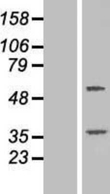 Western Blot: TTC23 Overexpression Lysate (Adult Normal) [NBP2-06381] Left-Empty vector transfected control cell lysate (HEK293 cell lysate); Right -Over-expression Lysate for TTC23.