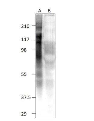 Western Blot: TTC27 Antibody [NBP3-12428] - TTC27 cDNA (A) and m-cherry control fish (B). 1:500 antibody dilution in DiluObuffer. Apparent MW is 120 KDa.