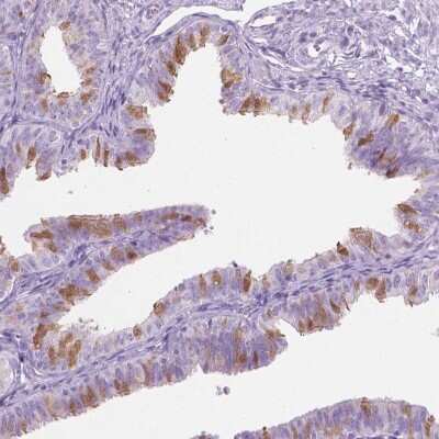 Immunohistochemistry: TTC29 Antibody [NBP2-49336] - Staining of human fallopian tube shows positivity in cilia and ciliated cells.
