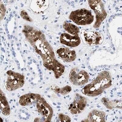 Immunohistochemistry-Paraffin: TTC3 Antibody [NBP1-84293] - Staining of human kidney shows strong cytoplasmic and nuclear positivity in tubule cells.