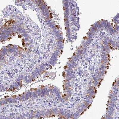 Immunohistochemistry: TTC30B Antibody [NBP2-46805] - Staining of human fallopian tube shows distinct positivity in cilia.