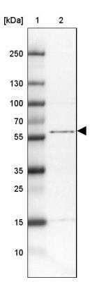 Western Blot TTC31 Antibody - BSA Free