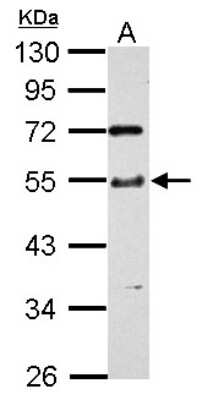 Western Blot: TTC31 Antibody [NBP2-20754] - Sample (30 ug of whole cell lysate) A: THP-1 10% SDS PAGE gel, diluted at 1:1000.