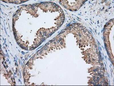 Immunohistochemistry: TTC32 Antibody (OTI1F7) - Azide and BSA Free [NBP2-74656] - Staining of paraffin-embedded Human prostate tissue using anti-TTC32 mouse monoclonal antibody.
