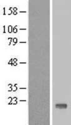 Western Blot: TTC32 Overexpression Lysate (Adult Normal) [NBL1-17407] Left-Empty vector transfected control cell lysate (HEK293 cell lysate); Right -Over-expression Lysate for TTC32.