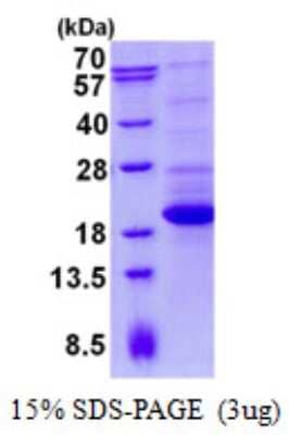 SDS-Page: TTC32 Protein [NBP2-22857]