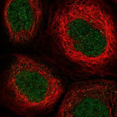 Immunocytochemistry/ Immunofluorescence TTC33 Antibody - BSA Free