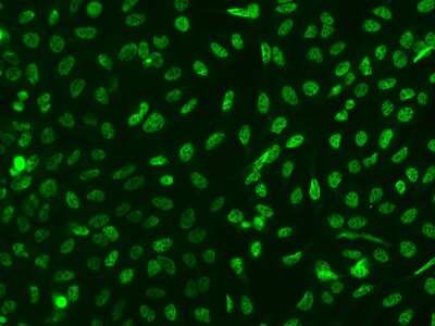 Immunocytochemistry/Immunofluorescence: TTC33 Antibody [NBP2-97329] - Immunofluorescence staining of TTC33 in U2OS cells. Cells were fixed with 4% PFA, permeabilzed with 0.1% Triton X-100 in PBS, blocked with 10% serum, and incubated with rabbit anti-Human TTC33 polyclonal antibody (dilution ratio 1:200) at 4C overnight. Then cells were stained with the Alexa Fluor(R)488-conjugated Goat Anti-rabbit IgG secondary antibody (green). Positive staining was localized to Nucleus.