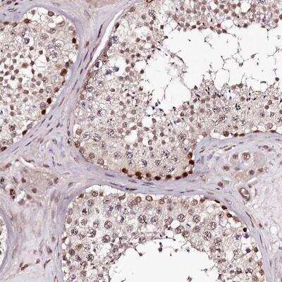 Immunohistochemistry: TTC33 Antibody [NBP1-82469] - Staining of human testis shows nuclear and cytoplasmic positivity in cells in seminiferous ducts and Leydig cells.