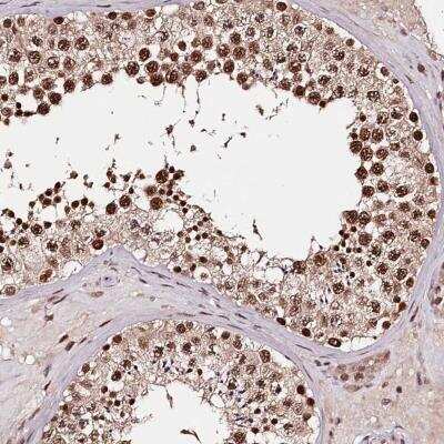 Immunohistochemistry-Paraffin: TTC33 Antibody [NBP1-82468] - Staining of human testis shows strong nuclear positivity in cells in seminiferous ducts.