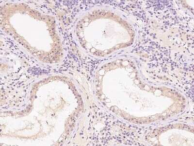 Immunohistochemistry-Paraffin: TTC33 Antibody [NBP2-99640] - Immunochemical staining of human TTC33 in human testis with rabbit polyclonal antibody at 1:200 dilution, formalin-fixed paraffin embedded sections.