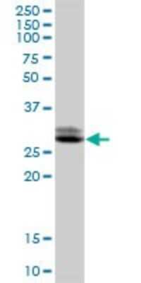 Western Blot: TTC33 Antibody [H00023548-B01P] - Analysis of TTC33 expression in Jurkat.